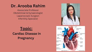 Cardiac Disease in Pregnancy [upl. by Snider302]