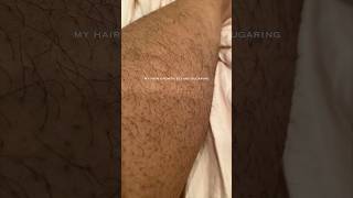 my Body Hair BEFORE vs AFTER sugaring 🍯 sugarwax [upl. by Helprin102]