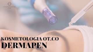 Dermapen  ile zabiegów przebieg zabiegu efekty przed i po  OTCO Clinic [upl. by Sahcnip129]