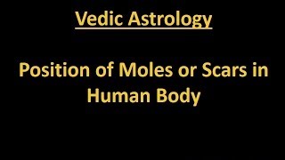 Vedic Astrology 印度占星学  Position of Moles or Scars in Human Body [upl. by Tnecillim]