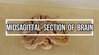 Midsagittal Section of Brain  neuroanatomy [upl. by Ahsimet]