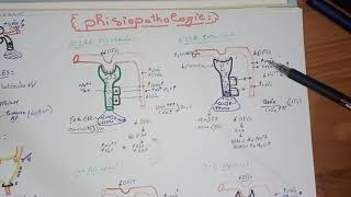 4tout savoir sur linsuffisance rénale aiguë IRAphysiopathologie lIRA intra rénal organique [upl. by Robyn241]