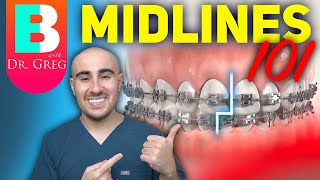 Braces Midlines 101  Elastics IPR Coils and more [upl. by Knight]