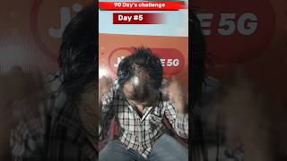 Day 5 use minoxidil morr f5 result  adivasi hair oil results haircare adivasihairoil minoxidil [upl. by Elyk]