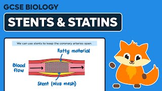 Stents amp Statins  GCSE Biology [upl. by Nauquf392]