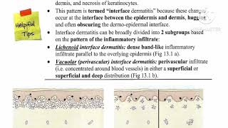 1 Lichenoid Review ✅ Lichen planus 🔸 Lichenoid drug eruption by Dr Ahmed Kamel [upl. by Kaja]