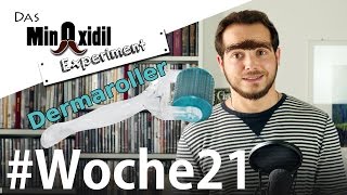 Was ist ein Dermaroller  Das Minoxidil Experiment Woche21 [upl. by Ariam510]