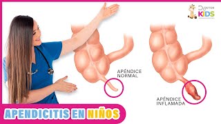 APENDICITIS EN NIÑOS síntomas  causas y tratamiento [upl. by Norrek]