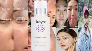 Kaya Purifying Toner  Honest Review [upl. by Ayinat]