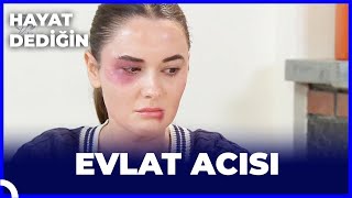 Hayat Dediğin  Evlat Acısı [upl. by Ehc]