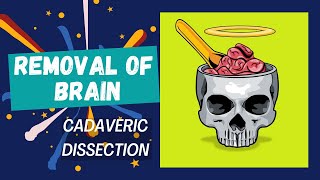 Removal of Brain  A cadaveric dissection  Anatomy [upl. by Aicargatla78]