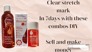 Get Rid of Stretch Marks Fast with This 3 Combo in Just 7 Days [upl. by Stalker]