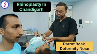 Rhinoplasty In Chandigarh  Rhinoplasty Surgery Cost In Chandigarh  Zenith Clinic [upl. by Melisande]