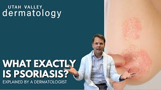 What Exactly IS Psoriasis  Utah Valley Dermatology [upl. by Norrad]