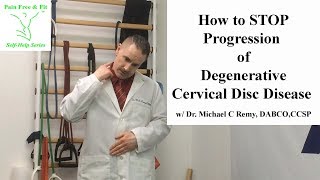 How to Stop Progression of Cervical Degenerative Disc Disease Home Self Rehab Tutorial [upl. by Neale179]