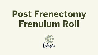 Post Frenectomy Frenulum Roll [upl. by Digirb]