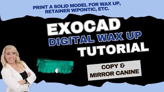 Exocad 32 digital wax up with copy amp mirror [upl. by Savitt]