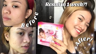 BRILLIANT SKIN REJUVENATING SET 1 WEEK HONEST REVIEW ✨ [upl. by Aloeda307]