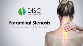 Pinched Nerve in Neck or Back Foraminal Stenosis Causes Symptoms Treatments [upl. by Budge]