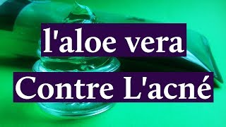 Comment Utiliser laloe Vera Pour Lacné [upl. by Yniattirb]