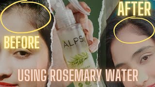 ALPS Goodness rosemary water review 30 days Hari growth challenge hair video youtube rosemary [upl. by Cinnamon]