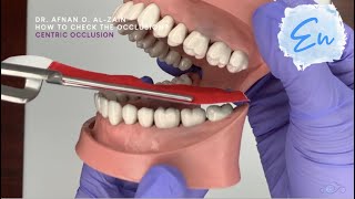 How to check the occlusion  En [upl. by Alisan]