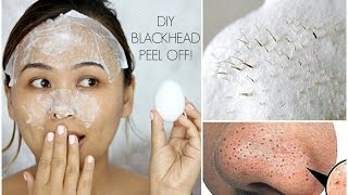 DIY Blackhead Peel Off Mask with an Egg  It Actually WORKS [upl. by Harrietta]