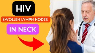 HIV Swollen Lymph Nodes in Neck [upl. by Nrubliw348]