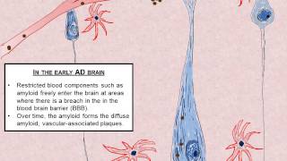 Alternative Hypothesis of Neuronal Death in Alzheimers disease [upl. by Kcinnay]