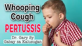 Whooping Cough Pertussis Causes Symptoms amp Treatment  Dr Gary Sy [upl. by Sarah]