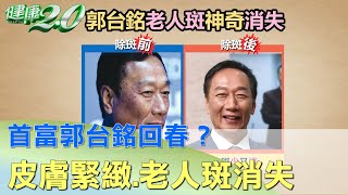 首富回春？ 郭台銘皮膚緊緻 老人斑神奇消失 健康20 [upl. by Arie]