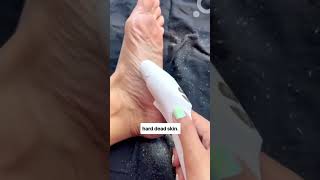 Salon like pedicure at home in just 10 minutes PROTOUCH Callus Remover [upl. by Caralie737]