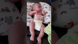 Focal Seizure in BabyInfant [upl. by Yelsel]