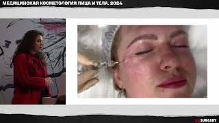 AASURGERY2024Лечение дерматохалязиса методом вакуумно фракционной блефаропластикиАлла Королева [upl. by Wilterdink70]