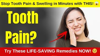 tooth pain and swelling home remedy  Heal Tooth Pain Fast No Dentist Just Home Remedies 🌿💖 [upl. by Crispa610]