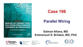 Case 196 Manual of CTO PCI  Parallel wiring [upl. by Gert]