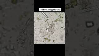 ➡️ Trichostrongylus Ova microbiology parasite [upl. by Nairdad]