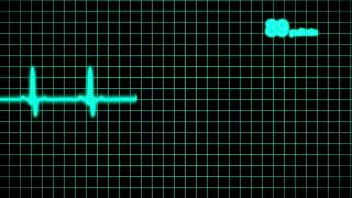 Cardiogram 1080p [upl. by Neill]