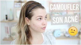 Tutoriel Maquillage n°34   CAMOUFLER SON ACNÉ [upl. by Enibas]