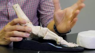 How to tell if your foot orthotics are truly custommade [upl. by Adyam848]