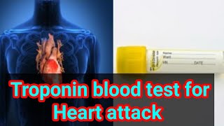 Troponin cTnI cTnT  or troponin I or Troponin T blood test cardiac markers [upl. by Yenhpad]