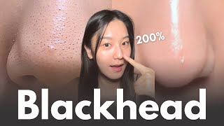 How to really remove blackheads at home in 7 days No matter your skin type [upl. by Fayth412]