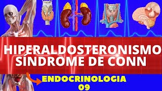 HIPERALDOSTERONISMO SÍNDROME DE CONN  ENDOCRINOLOGIA [upl. by Christye]