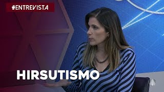 Saiba tudo sobre hirsutismo [upl. by Novart]