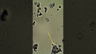 How dosa batter looks under microscope part2 [upl. by Perry879]