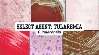 Morphology Moments  Tularemia [upl. by Esilrahc321]