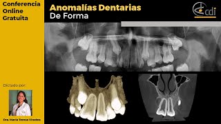 Conferencia Online ANOMALÍAS DENTARIAS DE FORMA [upl. by Adnopoz934]