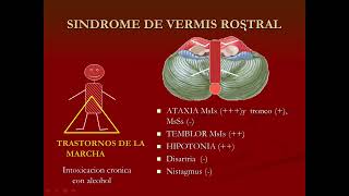 2024 Fisiopatologia de Sindromes Cerebelosos [upl. by Chester]