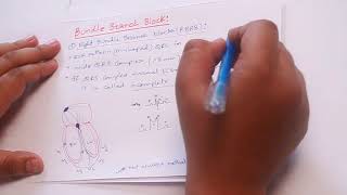 ECG 10 Bundle branch block  RBBBLBBB Bifascicular block tri fascicular block [upl. by Danie242]