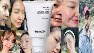 Minimalist Retinol 02 Liposomal Cream  Honest Review [upl. by Rebah]